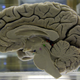 Human Brain. AP